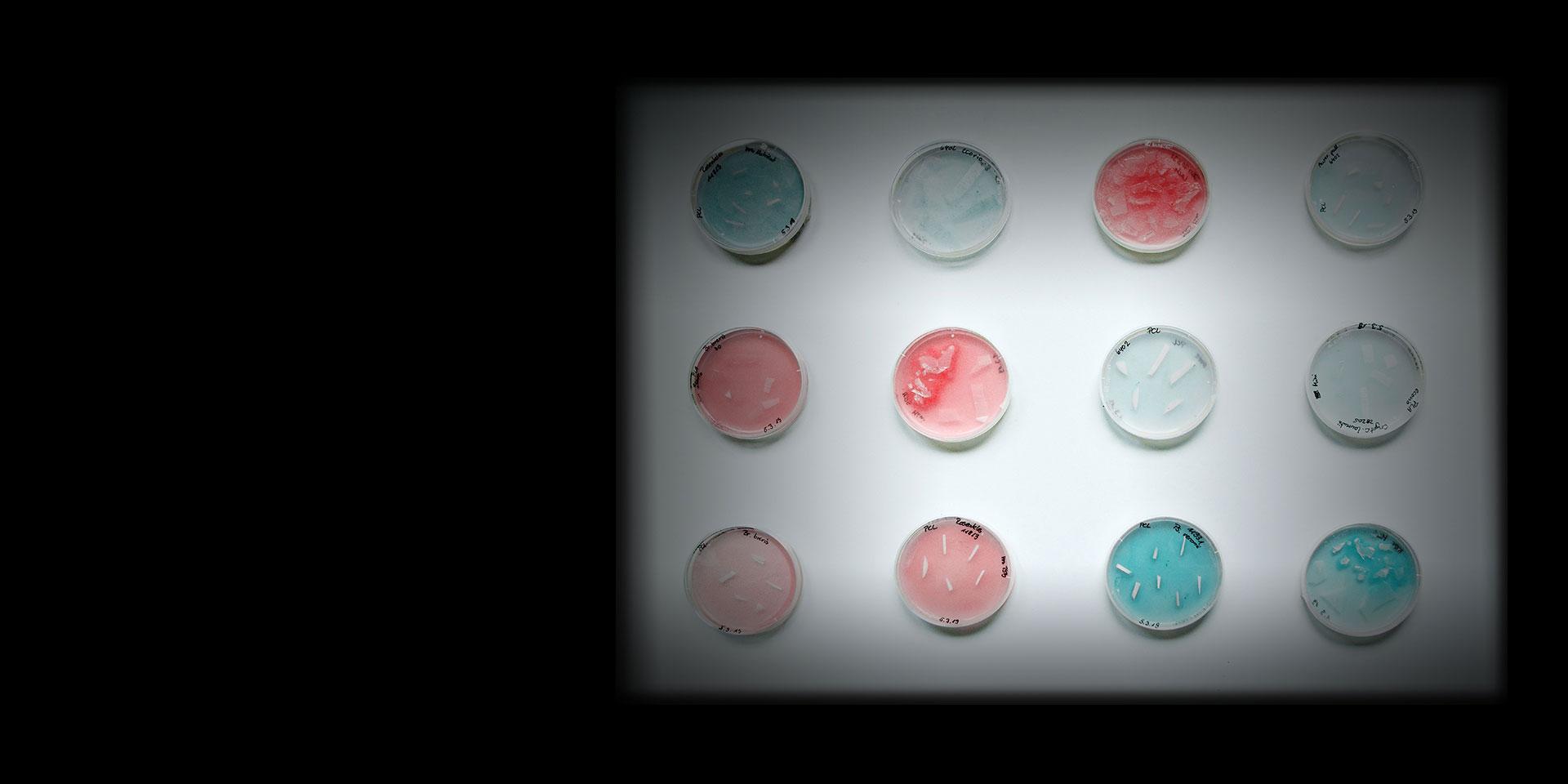 Microorganisms in Petri dishes